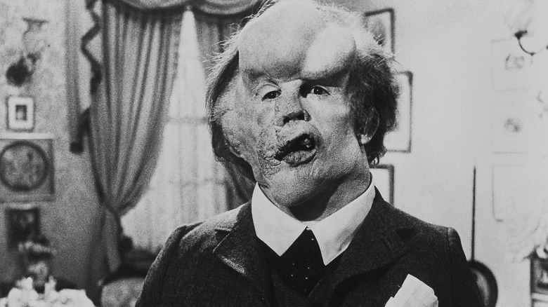 John Merrick sitting in a chair in "The Elephant Man."