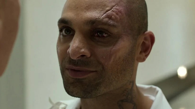 Mac Gargan with his scars