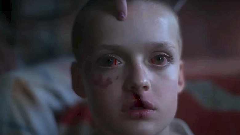 A blank-faced Oliver has a bruised face in "Bring Her Back" (2025)
