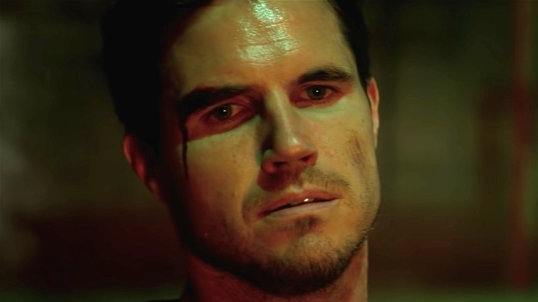 Robbie Amell with bloody eye in Resident Evil 