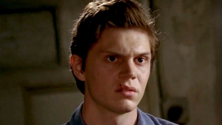 Kit Walker with cut lip