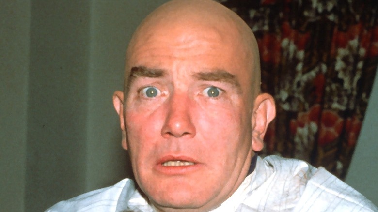 Albert Finney bald head as Daddy Warbucks