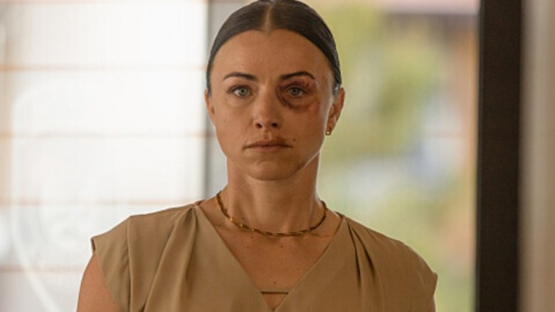 A bruised Hailey stares