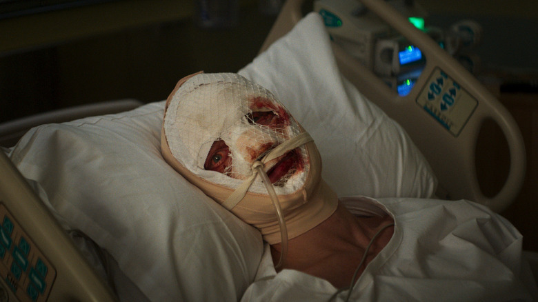 Matt Hagen with bandages over his face in Clayface