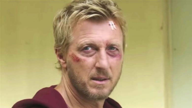 Johnny Lawrence bruised face