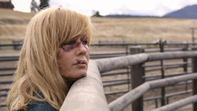 Beth Dutton resting bruised face on fence in "Yellowstone"