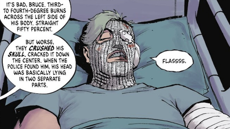 Harvey Dent with 50% of his body burned and bandaged in Absolute Batman #12