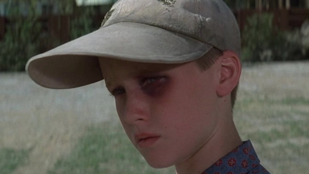 Smalls boasting a black eye Sandlot