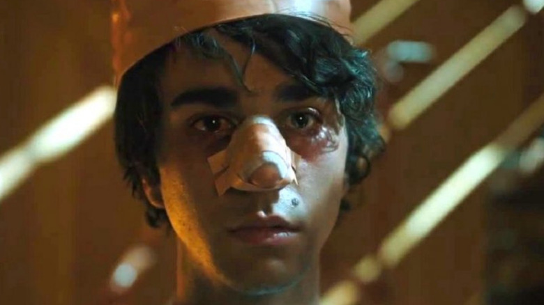 A bruised Alex Wolff