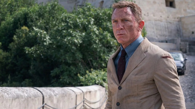James Bond injured