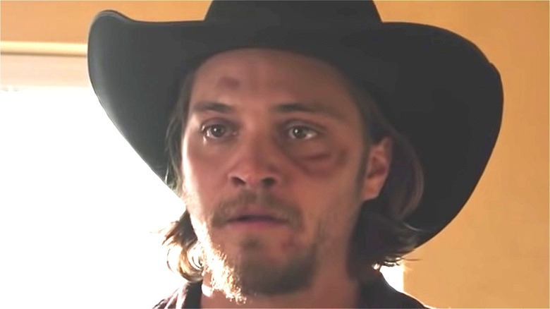 Luke Grimes Kayce Dutton black eye