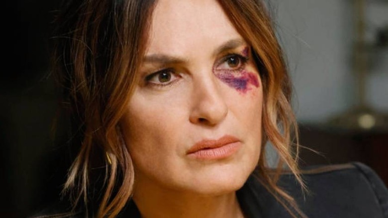 Olivia Benson with a bruise