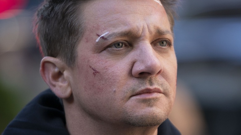 Hawkeye beat up