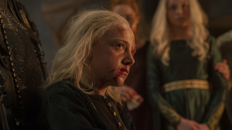 Young Aemond Targaryen with bloodied eye