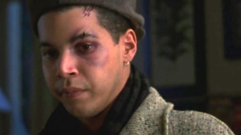 Rickie looking sad with a black eye