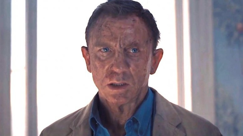 James Bond beat up