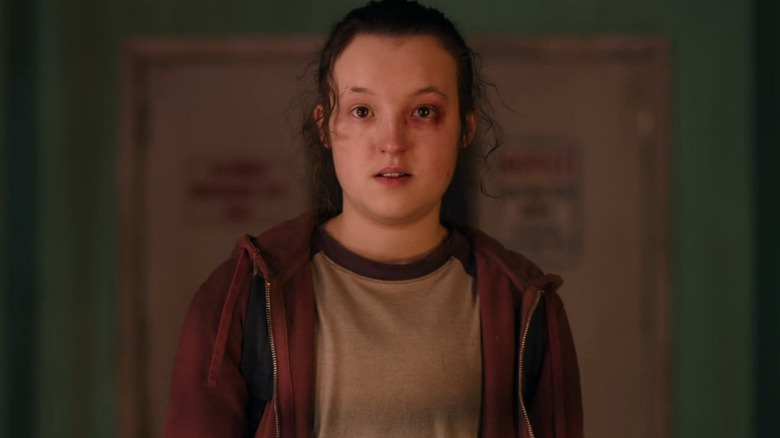 Ellie with black eye