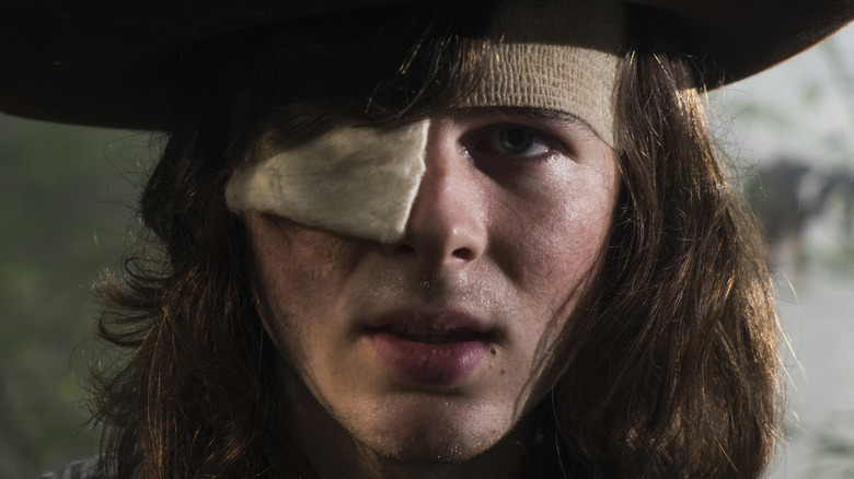 Carl Grimes wearing an eye patch looking grim