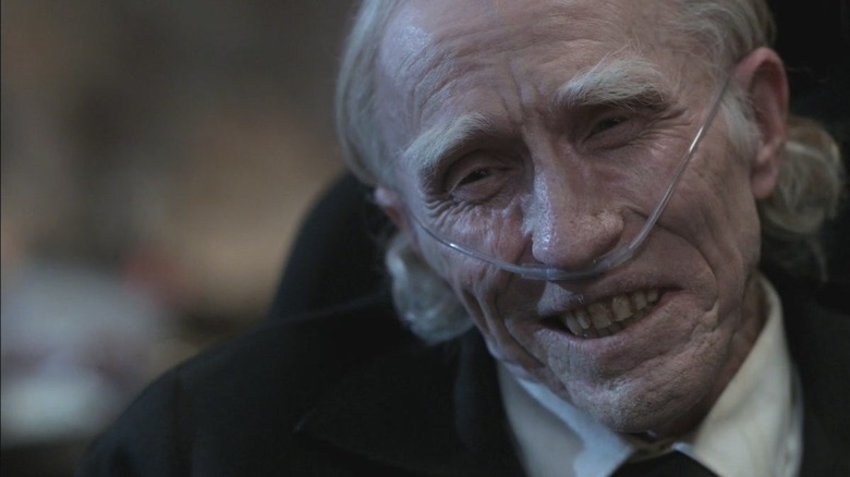 Famine smiling with oxygen in nose