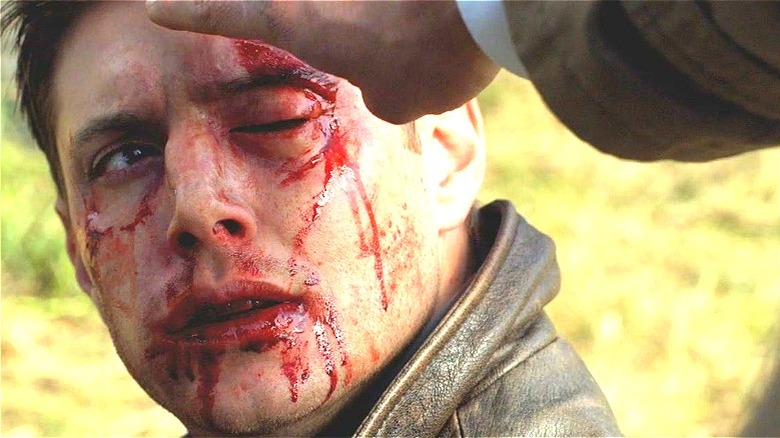 Cas healing Dean's bloody face