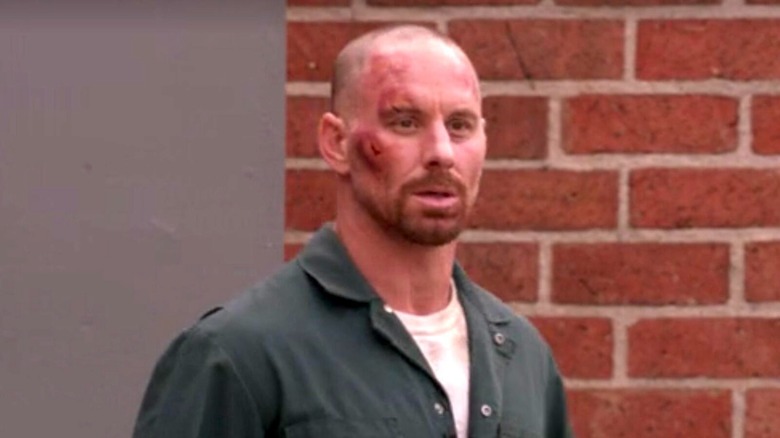 Ray Speltzer with a bruised face on Dexter.