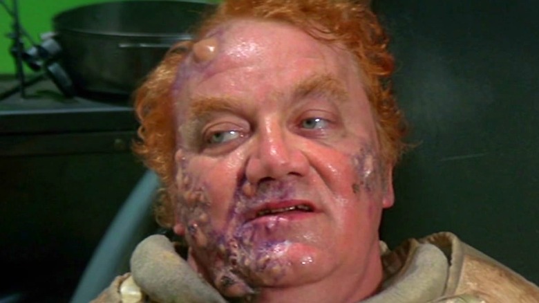 Baron Harkonnen grimacing