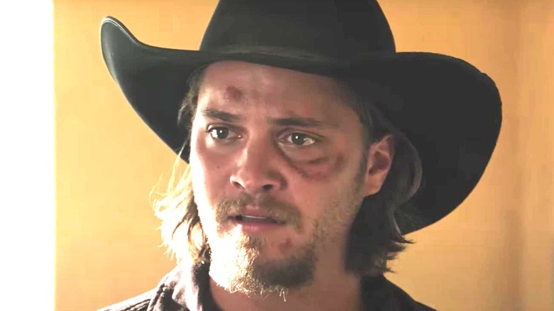 ECU Luke Grimes black eye