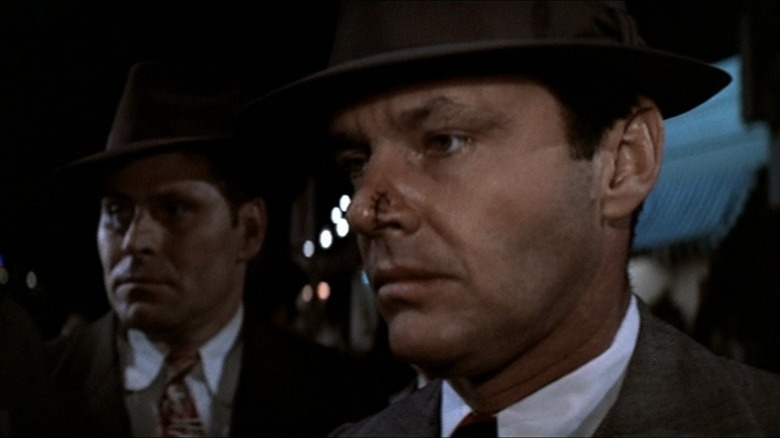 A scarred Jake Gittes stands next to one of his associates in "Chinatown" (1974)