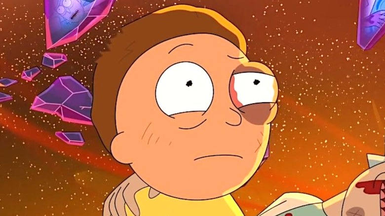 Morty with a black eye on 'Rick and Morty'