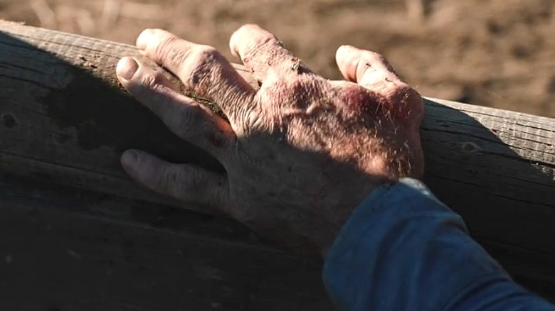 Lloyd's crushed hand in Yellowstone