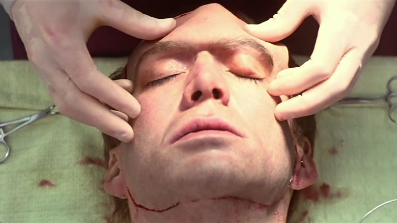 Surgeon removing Troy's face