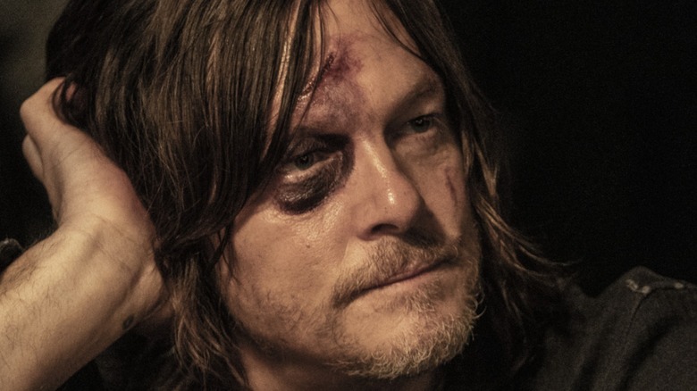 Daryl Dixon with a black eye on The Walking Dead