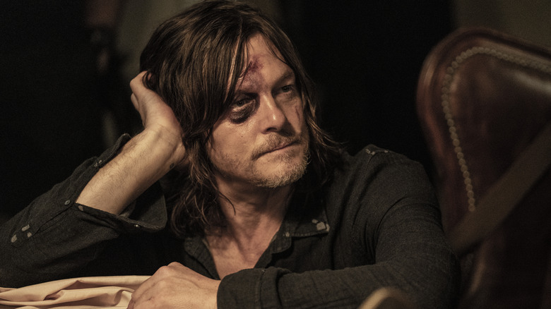 Daryl with a black eye