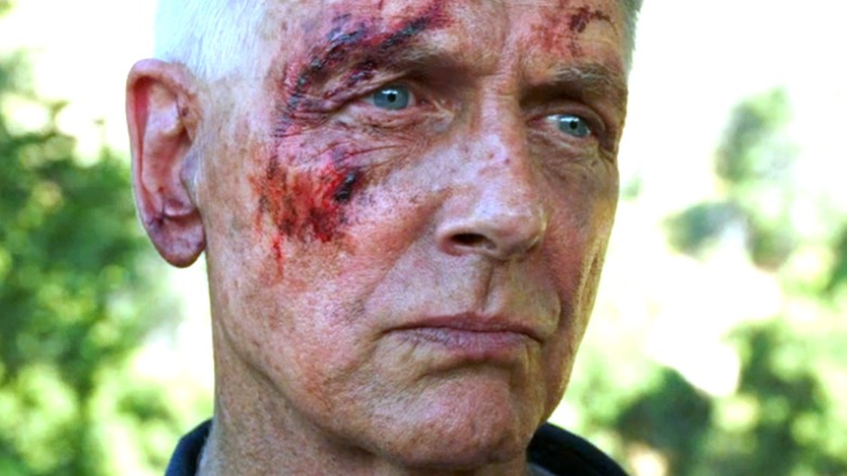 Gibbs bleeding