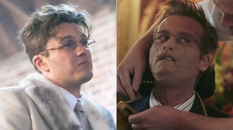 Michael Pitt as Mason Verger (left); Joe Anderson as Mason Verger (right) in "Hannibal"