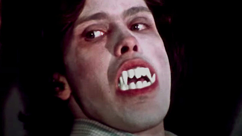 Martin shows vampire teeth