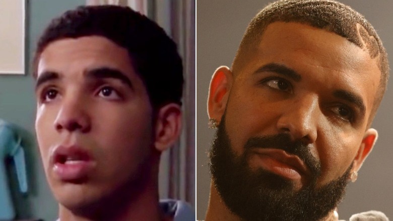 Drake then and now serious