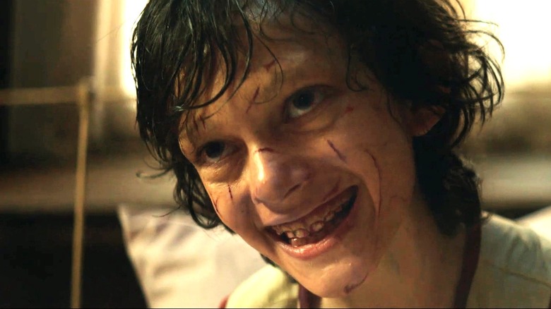 Possessed Henry grinning creepily with cuts on his face