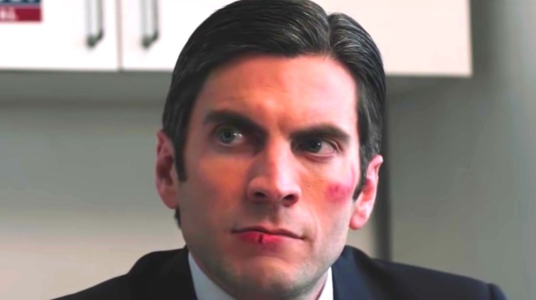 Jammie Dutton Wes Bentley bruise cut