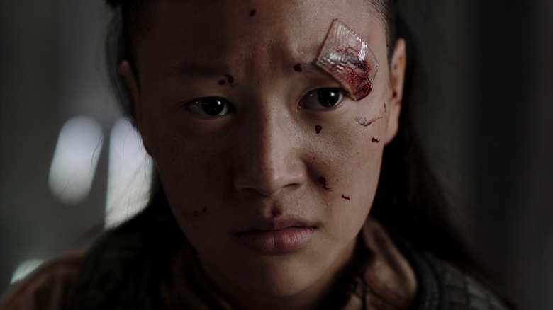 Quan Ah Yerin Ha bandage bloodied face