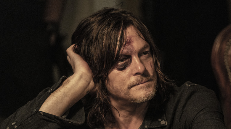 A bruised Daryl stares despondently