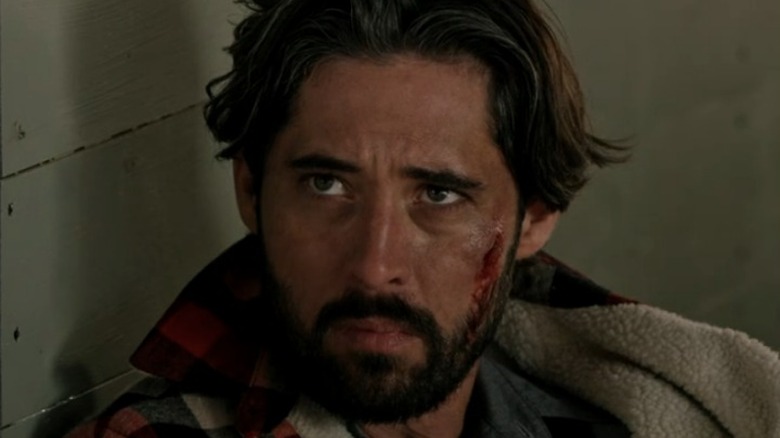 Walker with a bloody face in Yellowstone